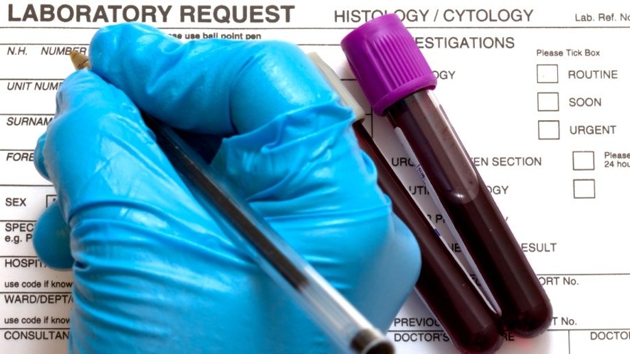 A simple blood test: Genetic mutations and breast cancer ...