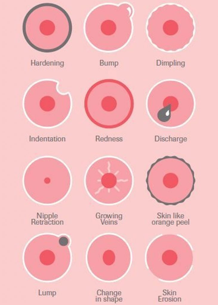All You Need To Know About Breast Cancer.