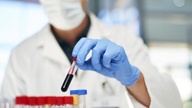 Blood test detects breast cancer five years before ...