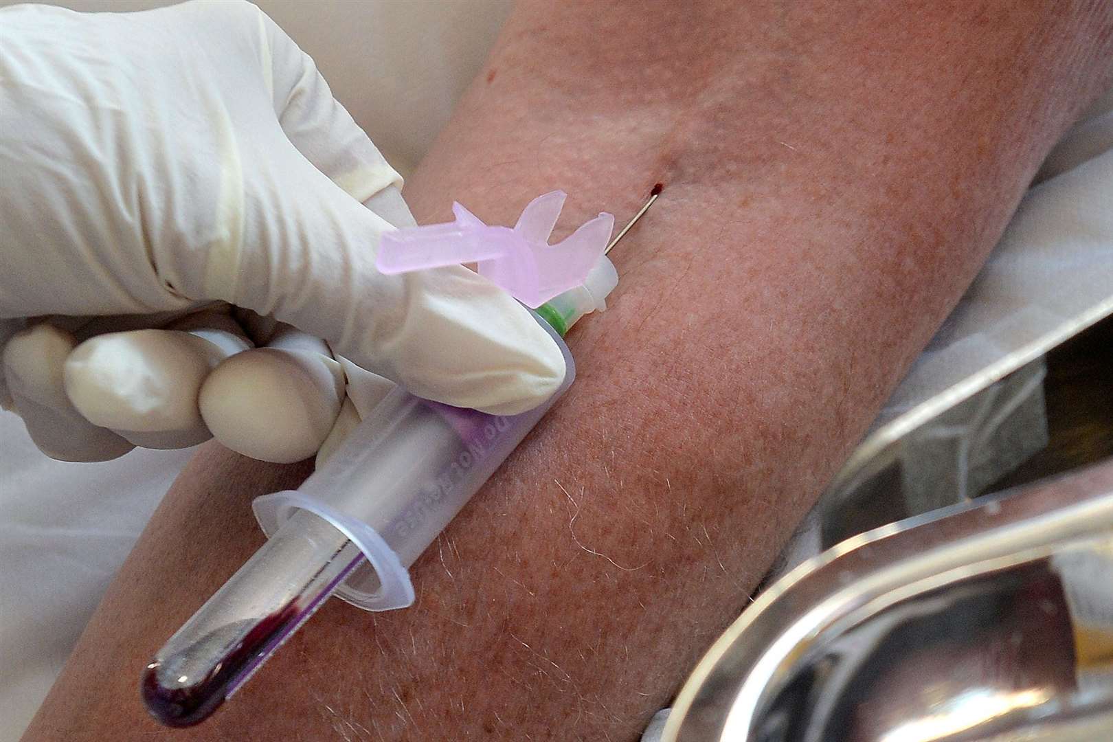 Blood test used to match breast cancer patients to most ...