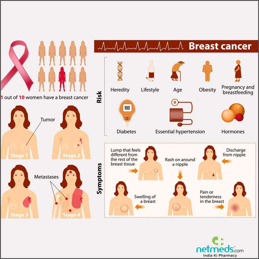 Breast Cancer: Causes, Symptoms And Treatment