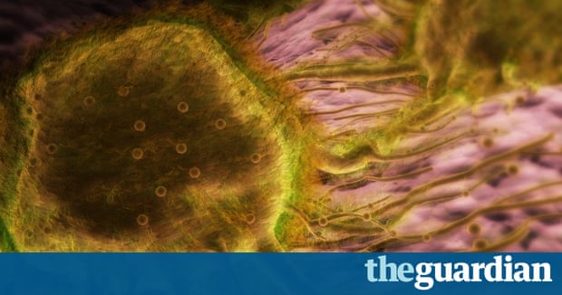 Breast cancer spread trigger discovered