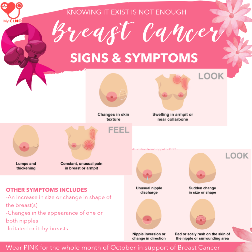 Breast Cancer : Symptoms and Signs. Lets bust the myth! â SSIVIX Lab