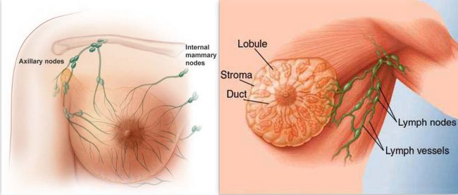 Breast Cancer Treatment By Natural Means