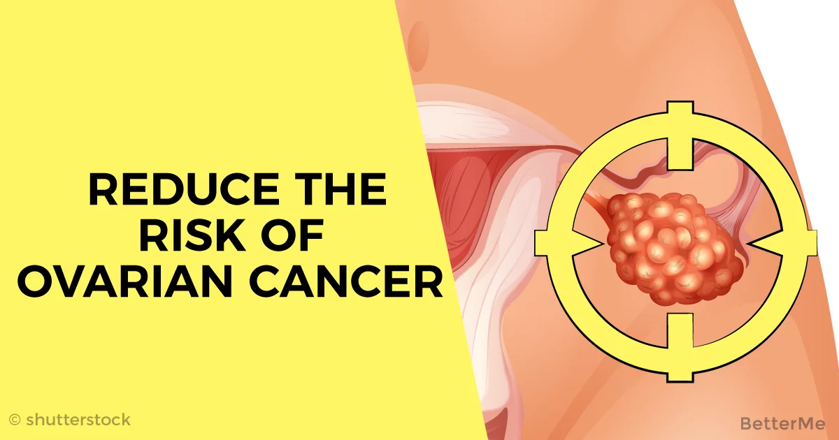 Can you reduce the risk of ovarian cancer naturally?