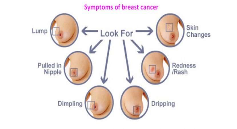 HOW CAN BREAST CANCER BE DETECTED â HEALTHY FOOD ADVICE