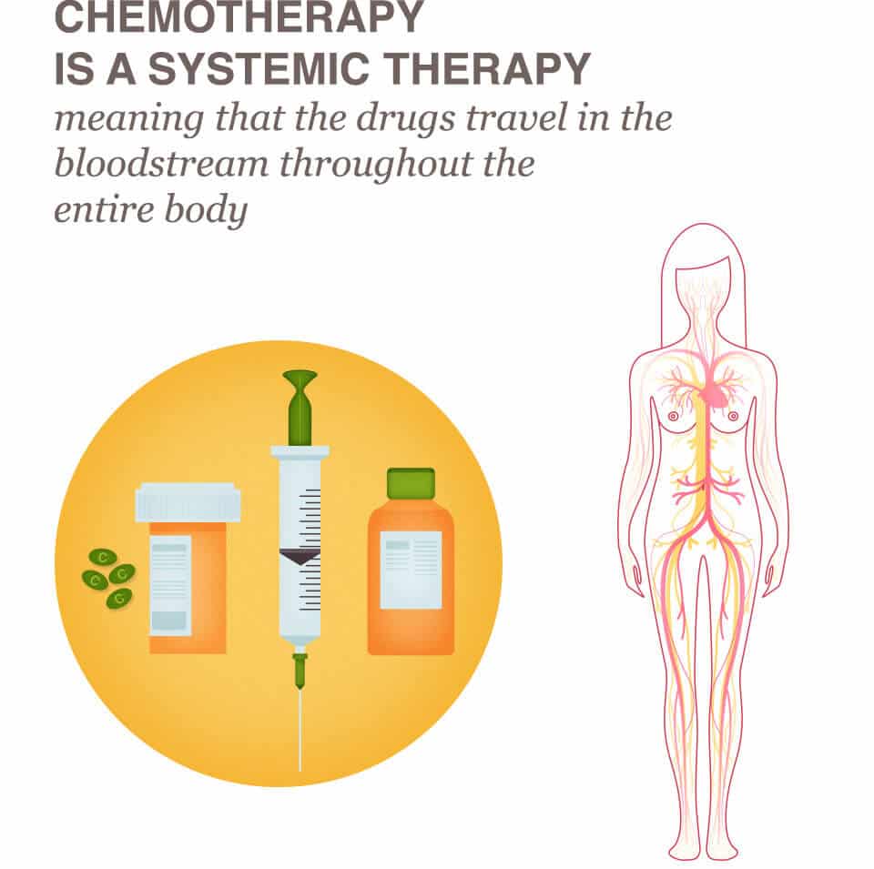 Is Chemotherapy Necessary For Stage 1 Breast Cancer