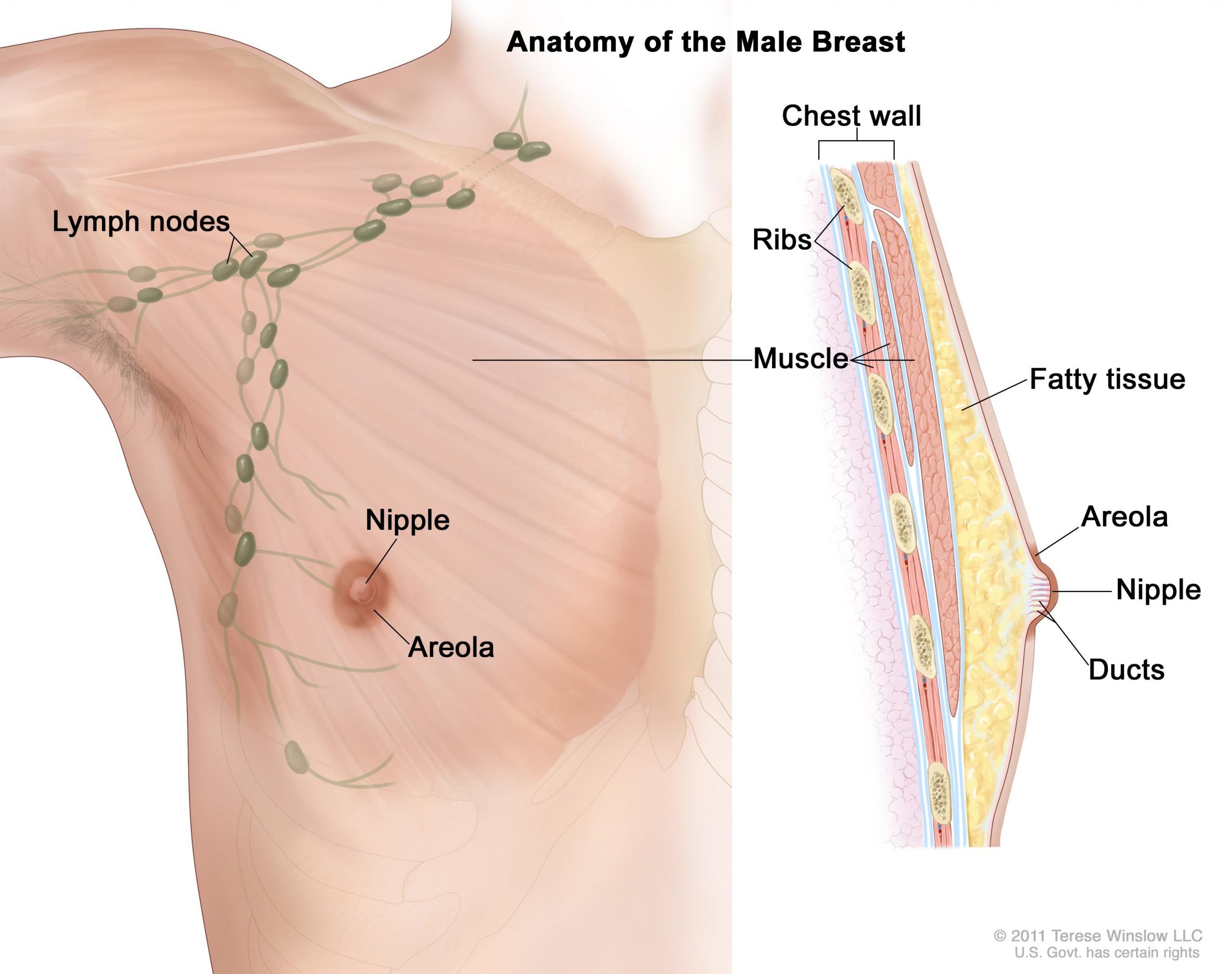Male Breast Cancer Treatment (PDQÂ®)âPatient Version ...