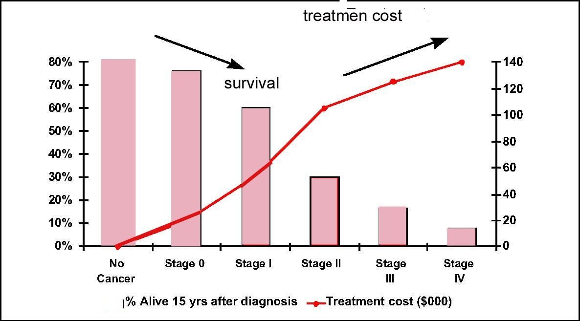 Stage Four Liver Cancer Survival Rate