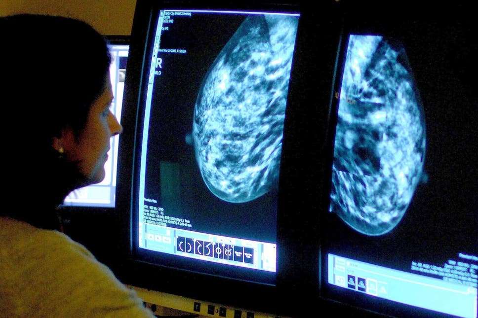 staggering 72 of terminal breast cancer patients dont get dedicated