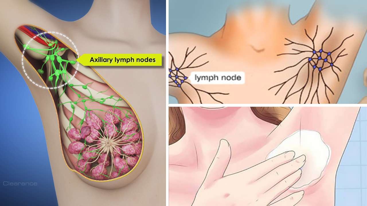 This Armpit Detox Helps Prevent Breast Cancer