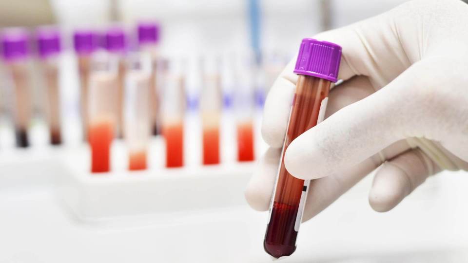 This New Breast Cancer Blood Test Is 100 Times More ...