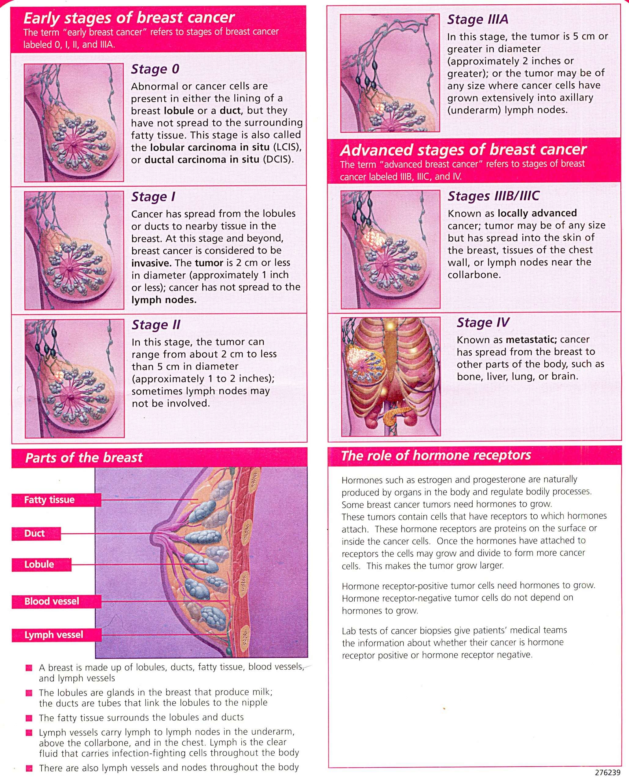 Visual Guide to The Stages of Breast Cancer â Rocking The ...